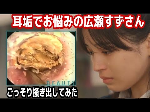 耳垢にお悩みの 広瀬すずさん の巨大耳くそをごっそり掻き出し除去 スッキリ気持ちいい神回 Yayafa