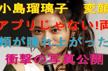 今日 の ニュース🍀🍀🍀🍀小島瑠璃子　変顔アプリじゃない!両頬が腫れ上がった衝撃の写真公開